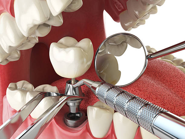 Best Dentist for Tooth Abscess  in Ephraim, UT
